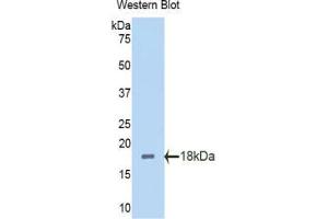Western blot analysis of the recombinant protein. (Polybromo 1 Antikörper  (AA 1152-1273))