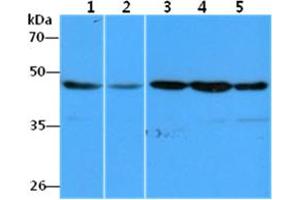 The Cell lysates (40ug) were resolved by SDS-PAGE, transferred to PVDF membrane and probed with anti-human EEF1A1 antibody (1:1000). (eEF1A1 Antikörper)