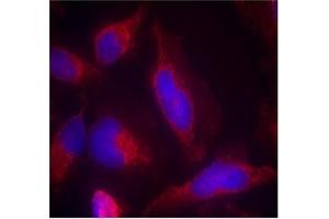 Image no. 2 for anti-Fms-Related tyrosine Kinase 3 (FLT3) (AA 589-593) antibody (ABIN401557) (FLT3 Antikörper  (AA 589-593))