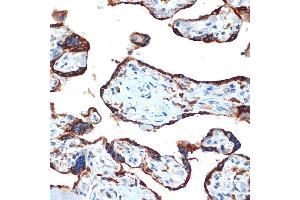Immunohistochemistry of paraffin-embedded human placenta using NAIP Rabbit mAb (ABIN7268931) at dilution of 1:100 (40x lens). (NAIP Antikörper)