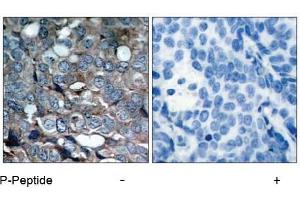 Image no. 1 for anti-Mitogen-Activated Protein Kinase Kinase Kinase 5 (MAP3K5) (pSer83) antibody (ABIN196913) (ASK1 Antikörper  (pSer83))