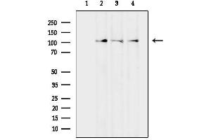 anti-Discoidin Domain Receptor tyrosine Kinase 1 (DDR1) (C-Term) antibody