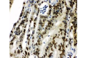IHC analysis of CCT3 using anti-CCT3 antibody (ABIN4886513).