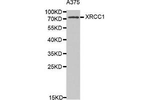 Western Blotting (WB) image for anti-X-Ray Repair Complementing Defective Repair in Chinese Hamster Cells 1 (XRCC1) (AA 1-320) antibody (ABIN1683300) (XRCC1 Antikörper  (AA 1-320))