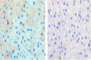 Left image is paraformaldehyde-fixed and paraffin-embedded cow lactating with CPT1A Pab , which was peroxidase-conjugated to the secondary antibody, followed by AEC staining, right image is contrast, did not add the antibody. (CPT1A Antikörper  (C-Term))