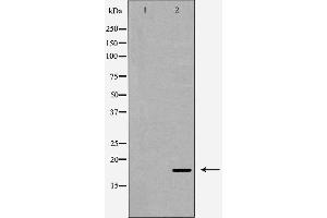 Western blot analysis of Caspase 6 (Cleaved-Asp179) expression in Hela cells. (Caspase 6 Antikörper  (Cleaved-Asp179))