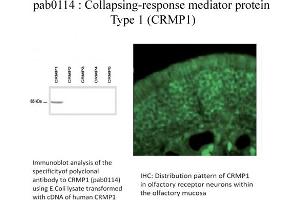 Image no. 1 for anti-Collapsin Response Mediator Protein 1 (CRMP1) (C-Term) antibody (ABIN347035) (CRMP1 Antikörper  (C-Term))