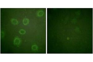 Immunofluorescence analysis of HuvEc cells, using HER2 (Phospho-Thr686) Antibody. (ErbB2/Her2 Antikörper  (pThr686))
