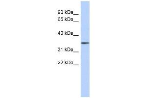 FBXO31 antibody used at 1 ug/ml to detect target protein. (FBXO31 Antikörper  (Middle Region))