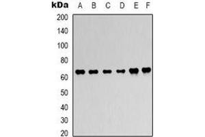 Western blot analysis of AMPK alpha 1 expression in Hela (A), 293T (B), C2C12 (C), NIH3T3 (D), rat heart (E), rat brain (F) whole cell lysates. (PRKAA1 Antikörper)