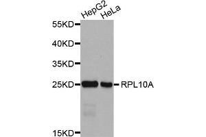 Western Blotting (WB) image for anti-Ribosomal Protein L10a (RPL10A) antibody (ABIN1876954) (RPL10A Antikörper)