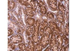 Immunohistochemistry (IHC) image for anti-Basic Leucine Zipper and W2 Domains 2 (BZW2) antibody (ABIN2856468)