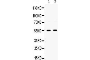 Western blot analysis of SMYD3 expression in HELA whole cell lysates (lane 1) and COLO320 whole cell lysates (lane 2). (SMYD3 Antikörper  (C-Term))