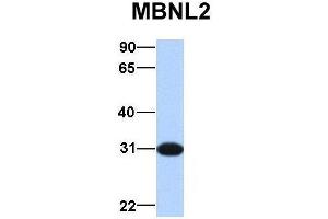 Host:  Rabbit  Target Name:  MBNL2  Sample Type:  Human Fetal Brain  Antibody Dilution:  1. (MBNL2 Antikörper  (Middle Region))