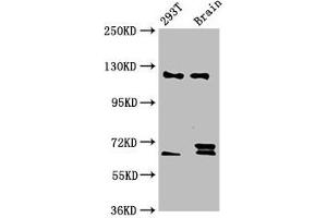 Western Blot Positive WB detected in: 293T whole cell lysate, Rat brain tissue All lanes: TCERG1 antibody at 5. (TCERG1 Antikörper  (AA 782-896))