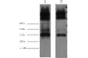 Western Blotting (WB) image for anti-EF-Hand Domain Family, Member D1 (EFHD1) antibody (ABIN5959455) (EFHD1 Antikörper)