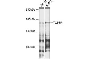 Western blot analysis of extracts of various cell lines, using TOPBP1 antibody (ABIN6134114, ABIN6149397, ABIN6149400 and ABIN6216254) at 1:1000 dilution. (TOPBP1 Antikörper  (AA 1-100))