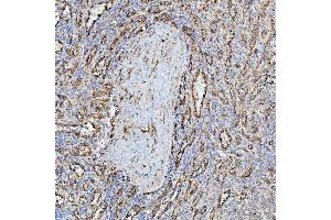 IHC analysis of PTRF/CAVIN1 using anti-PTRF/CAVIN1 antibody (ABIN7601817).