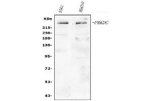 Western blot analysis of PRKDC using anti-PRKDC antibody (ABIN3042975).