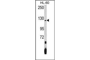 Image no. 1 for anti-Pumilio Homolog 1 (PUM1) (N-Term) antibody (ABIN360015) (PUM1 Antikörper  (N-Term))