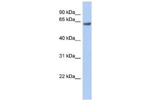 WB Suggested Anti-TBC1D10B Antibody Titration:  0. (TBC1D10B Antikörper  (Middle Region))