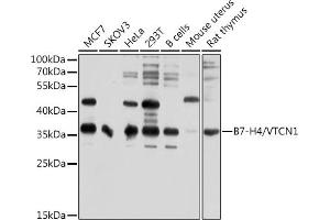 Western blot analysis of extracts of various cell lines, using B7-H4/VTCN1 antibody (ABIN6129975, ABIN6150157, ABIN6150158 and ABIN6214657) at 1:1000 dilution. (VTCN1 Antikörper  (AA 100-260))