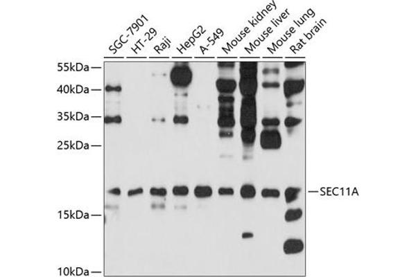SEC11A Antikörper  (AA 37-145)