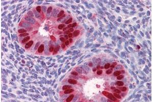 Human Uterus: Formalin-Fixed, Paraffin-Embedded (FFPE) (Deoxyuridine Triphosphatase (DUT) (AA 68-164) Antikörper)
