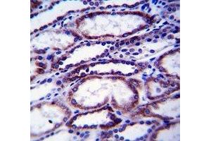 COL1A1 antibody immunohistochemistry analysis in formalin fixed and paraffin embedded human kidney tissue. (COL1A1 Antikörper  (AA 1077-1106))