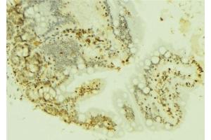 ABIN6277221 at 1/100 staining Mouse colon tissue by IHC-P. (FOXM1 Antikörper  (N-Term))