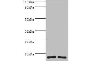 Western blot All lanes: RPS16 protein antibody at 2 μg/mL Lane 1: 293T whole cell lysate Lane 2: EC109 whole cell lysate Secondary Goat polyclonal to rabbit IgG at 1/15000 dilution Predicted band size: 17 kDa Observed band size: 17 kDa (RPS16 Antikörper  (AA 2-142))
