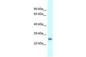 Image no. 1 for anti-Dermatopontin (DPT) (AA 45-94) antibody (ABIN6747613) (Dermatopontin Antikörper  (AA 45-94))