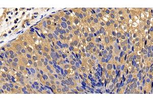 Immunohistochemistry (IHC) image for anti-Caspase 7, Apoptosis-Related Cysteine Peptidase (CASP7) (AA 207-303) antibody (ABIN7431803)