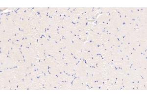 Detection of S100A8 in Bovine Esophagus Tissue using Polyclonal Antibody to S100 Calcium Binding Protein A8 (S100A8) (S100A8 Antikörper  (AA 1-89))