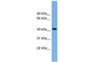WB Suggested Anti-MAPT  Antibody Titration: 0. (MAPT Antikörper  (Middle Region))