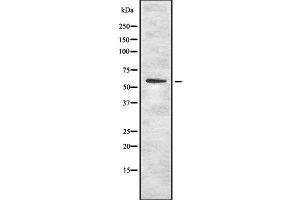 Western blot analysis OCT1 using K562 whole cell lysates (SLC22A1 Antikörper  (N-Term))