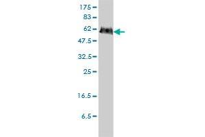 Western Blotting (WB) image for anti-Phosphoglucomutase 3 (PGM3) (AA 1-542) antibody (ABIN562199)