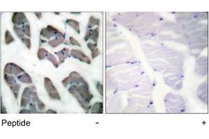 Immunohistochemical analysis of paraffin-embedded human muscle tissue using ACTG2 polyclonal antibody .