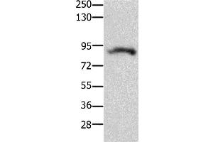 Western Blotting (WB) image for anti-Potassium Voltage-Gated Channel, Subfamily H (Eag-Related), Member 2 (KCNH2) antibody (ABIN2426047) (KCNH2 Antikörper)