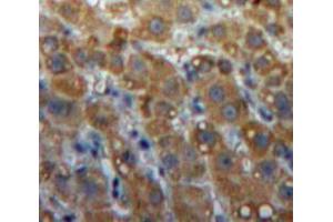 Used in DAB staining on fromalin fixed paraffin-embedded Liver tissue (LIPG Antikörper  (AA 115-369))