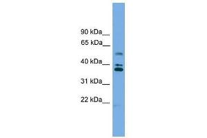 Western Blot showing LDLRAD3 antibody used at a concentration of 1-2 ug/ml to detect its target protein. (LDLRAD3 Antikörper  (Middle Region))