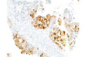 Immunohistochemistry (IHC) image for anti-Indoleamine 2,3-Dioxygenase 1 (IDO1) (AA 1-403) antibody (ABIN7449541) (Rekombinanter IDO1 Antikörper  (AA 1-403))