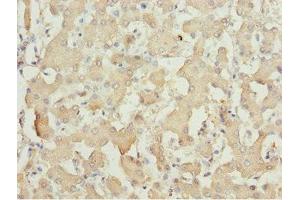 Immunohistochemistry of paraffin-embedded human liver tissue using ABIN7143362 at dilution of 1:100 (MOCS3 Antikörper  (AA 271-460))