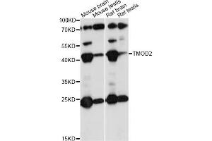Western blot analysis of extracts of various cell lines, using TMOD2 antibody (ABIN6291659) at 1:1000 dilution. (TMOD2 Antikörper)