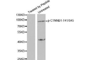 Western blot analysis of extracts from SW626 cells using Phospho-CTNNB1-T41/S45 antibody. (CTNNB1 Antikörper  (pSer45, pThr41))