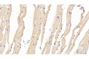 Immunohistochemistry (IHC) image for anti-Bone Morphogenetic Protein 2 (BMP2) (AA 281-394) antibody (ABIN7430393)
