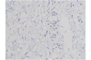 ABIN6267470 at 1/200 staining Human esophagus tissue sections by IHC-P. (AKT1 Antikörper  (pThr450))