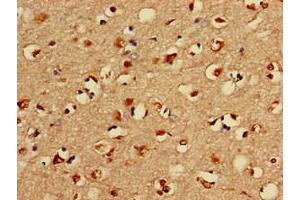 Immunohistochemistry of paraffin-embedded human brain tissue using ABIN7158354 at dilution of 1:100 (LIM Domain Kinase 1 Antikörper  (AA 179-320))