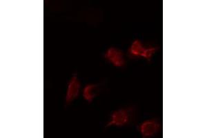 ABIN6274478 staining HepG2 cells by IF/ICC. (PKNOX2 Antikörper  (C-Term))