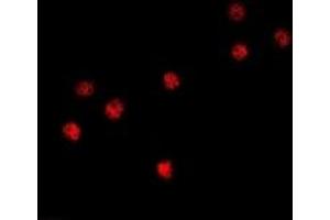 Immunofluorescent analysis of BOB1 staining in HT29 cells.